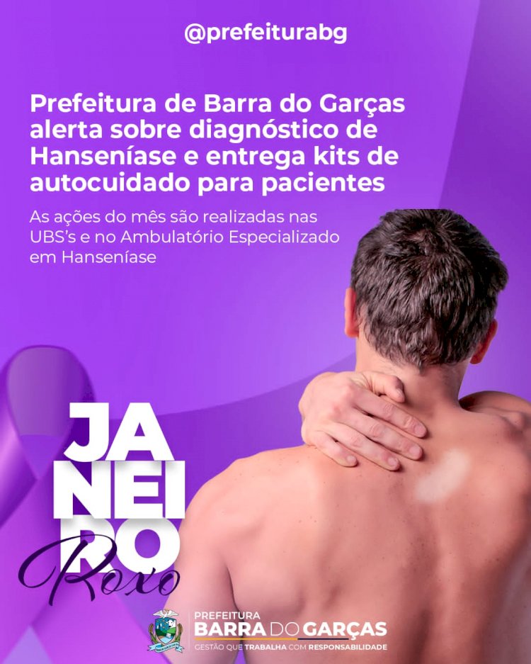 Janeiro roxo: Prefeitura de Barra do Garças alerta sobre diagnóstico de Hanseníase e entrega kits de autocuidado para pacientes