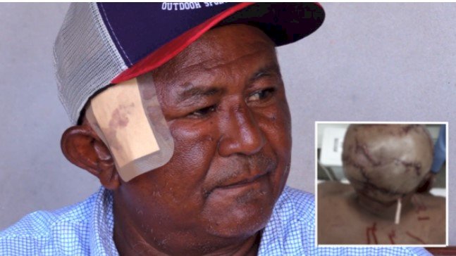 Índio é atacado por onça-pintada e sobrevive
